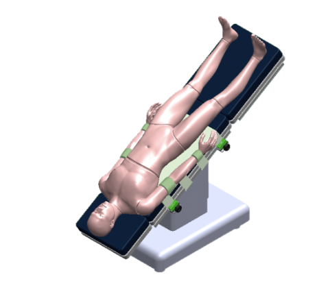 3D model of a patient on a medical examination table with adjustable supports.