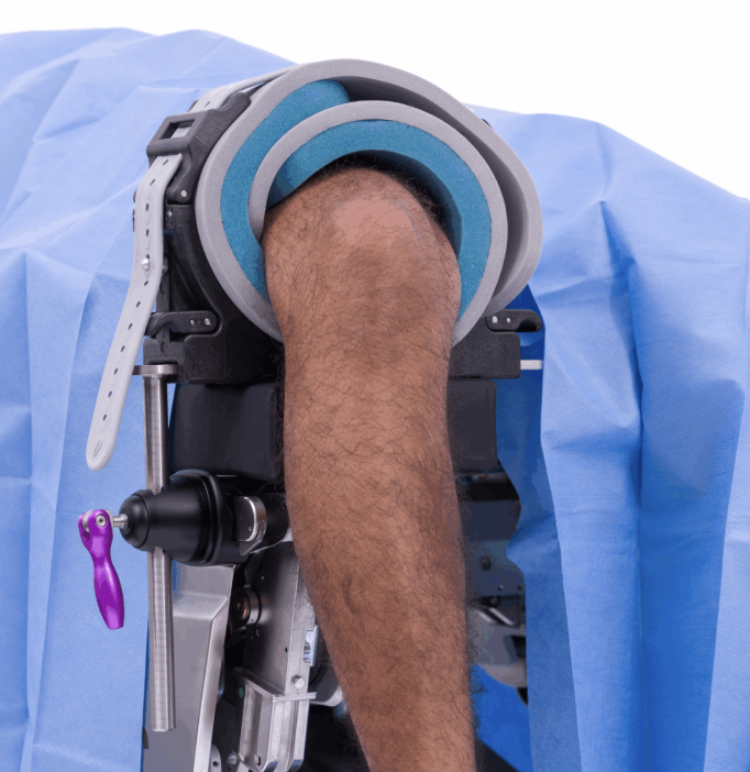 Close-up of a prosthetic leg attached to a person's limb.